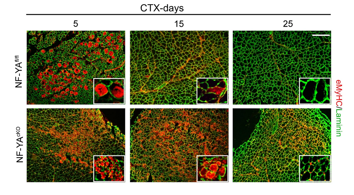 نقش فاکتور رونویسی NF-Y در تصمیم‌گیری سرنوشت سلول‌های بنیادی و بازسازی عضله اسکلتی بزرگسالان 